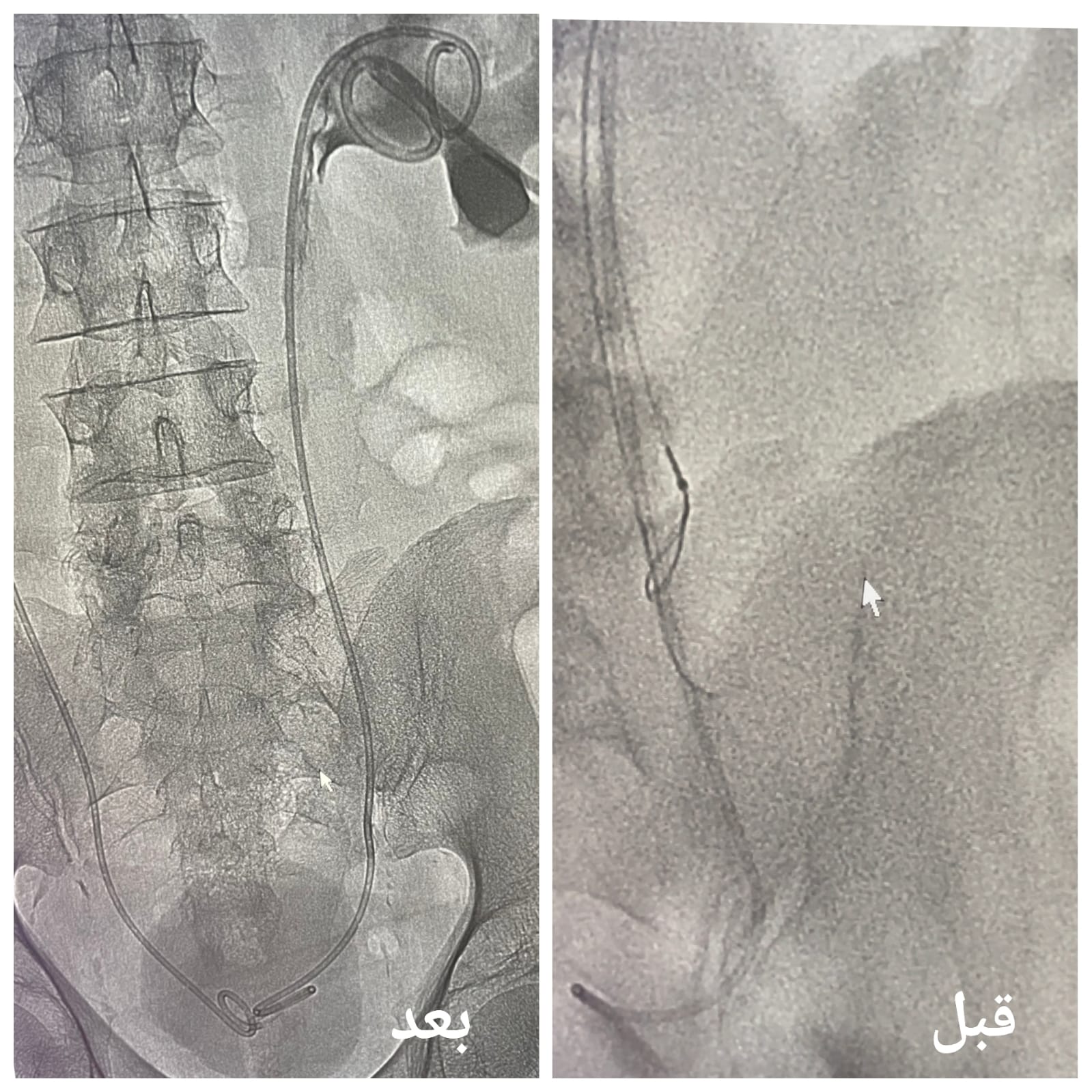 صورة الخبر