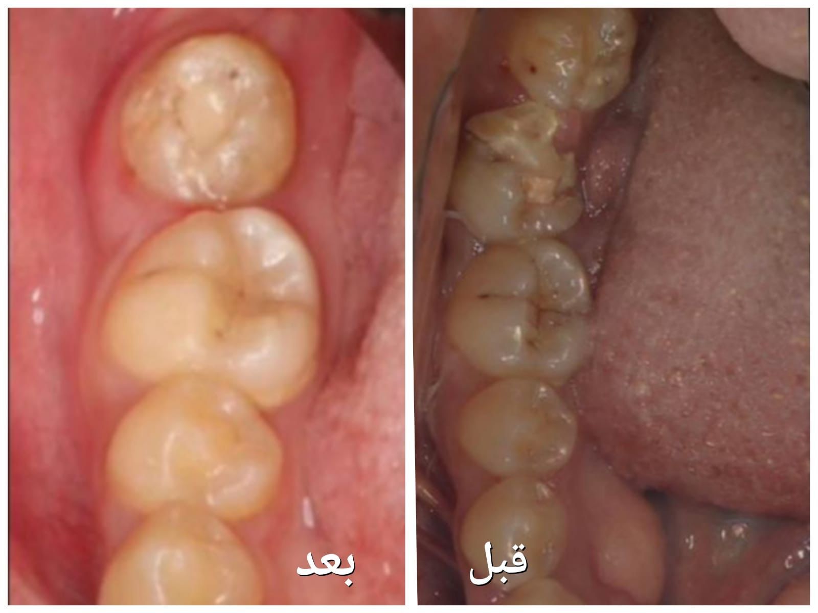 صورة الخبر