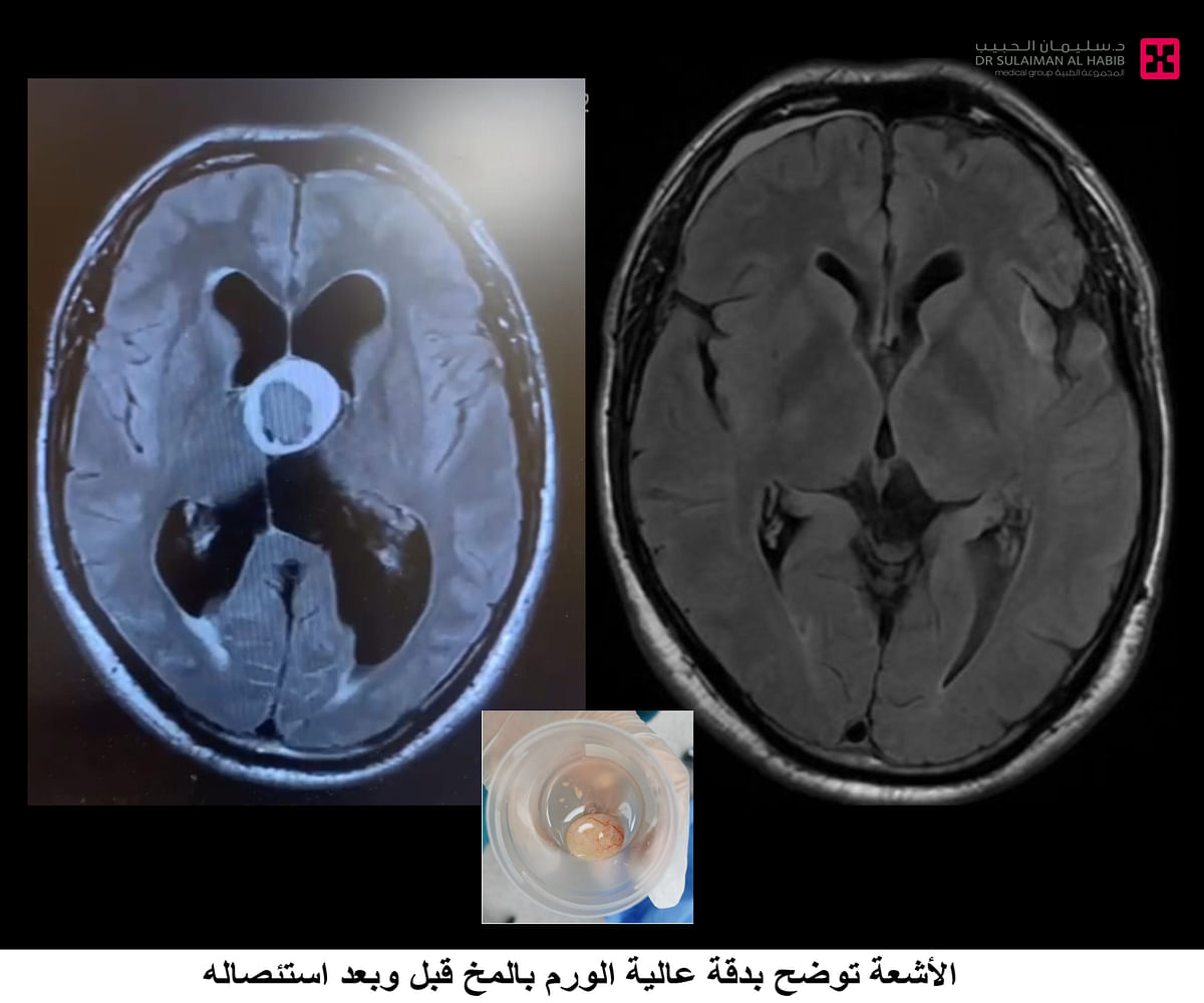 صورة الخبر