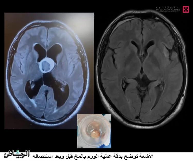 صورة الخبر