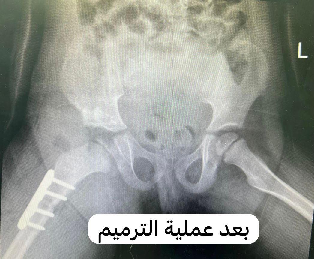 صورة الخبر