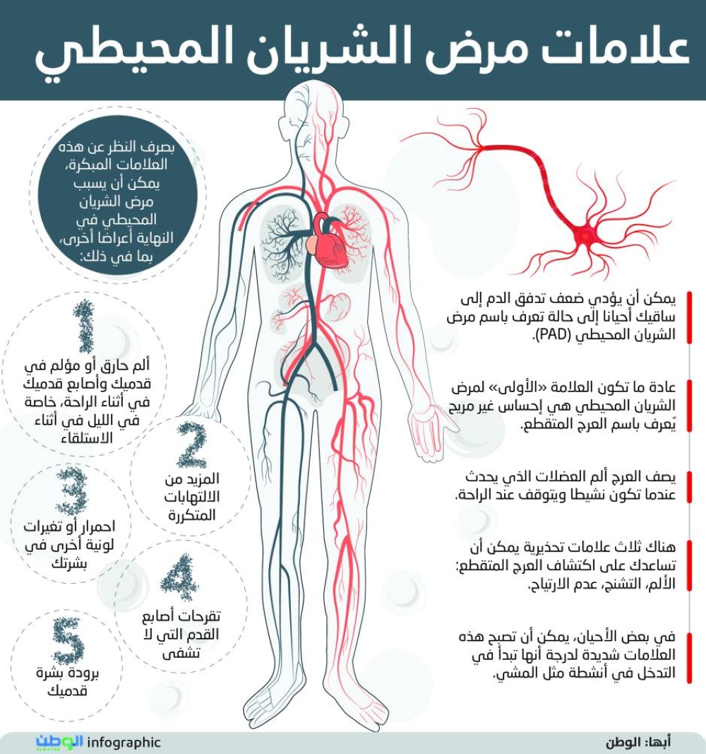 صورة الخبر