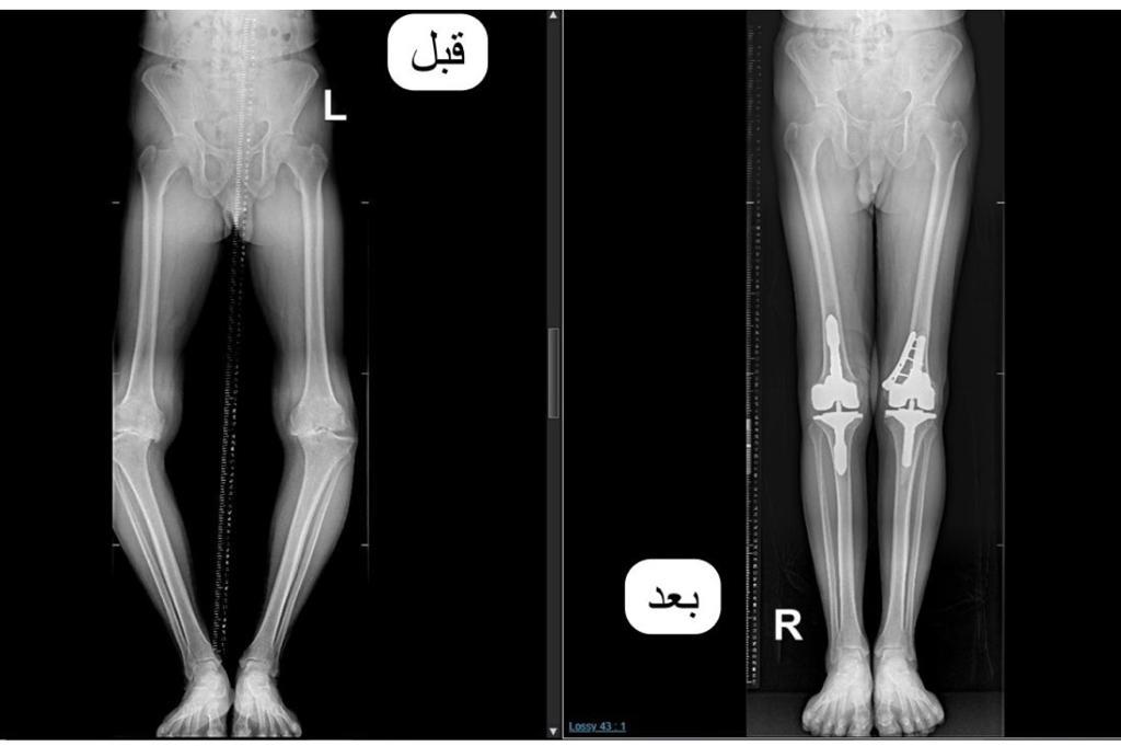 صورة الخبر