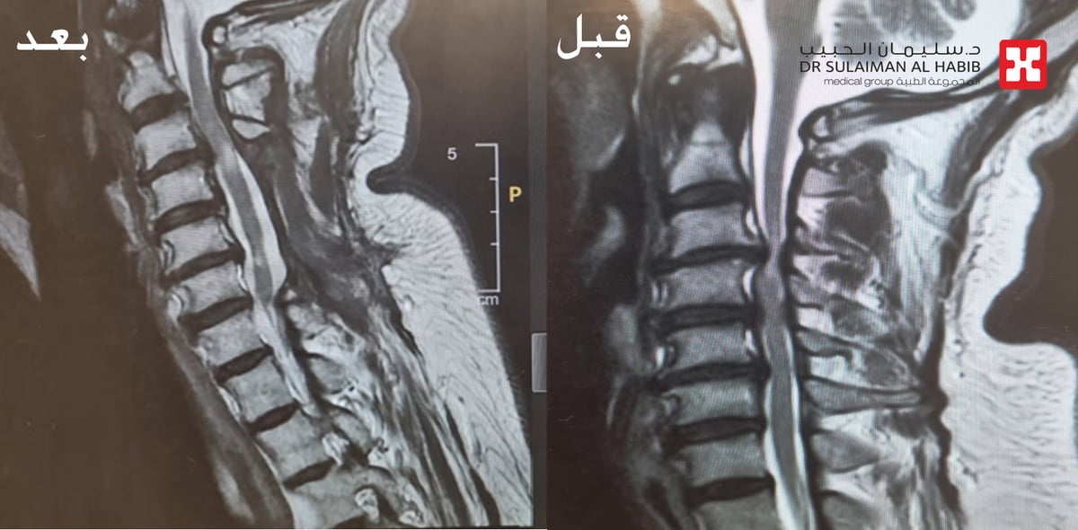 صورة الخبر