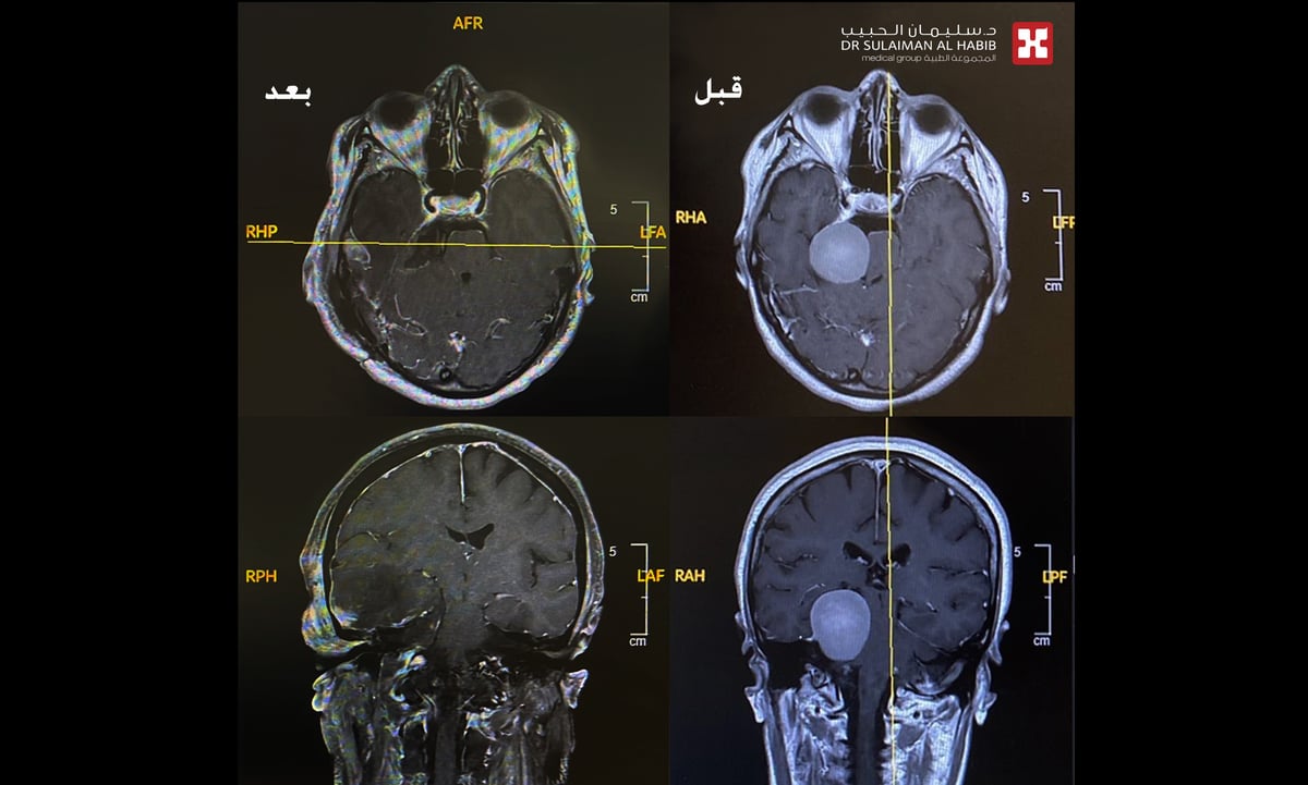 صورة الخبر