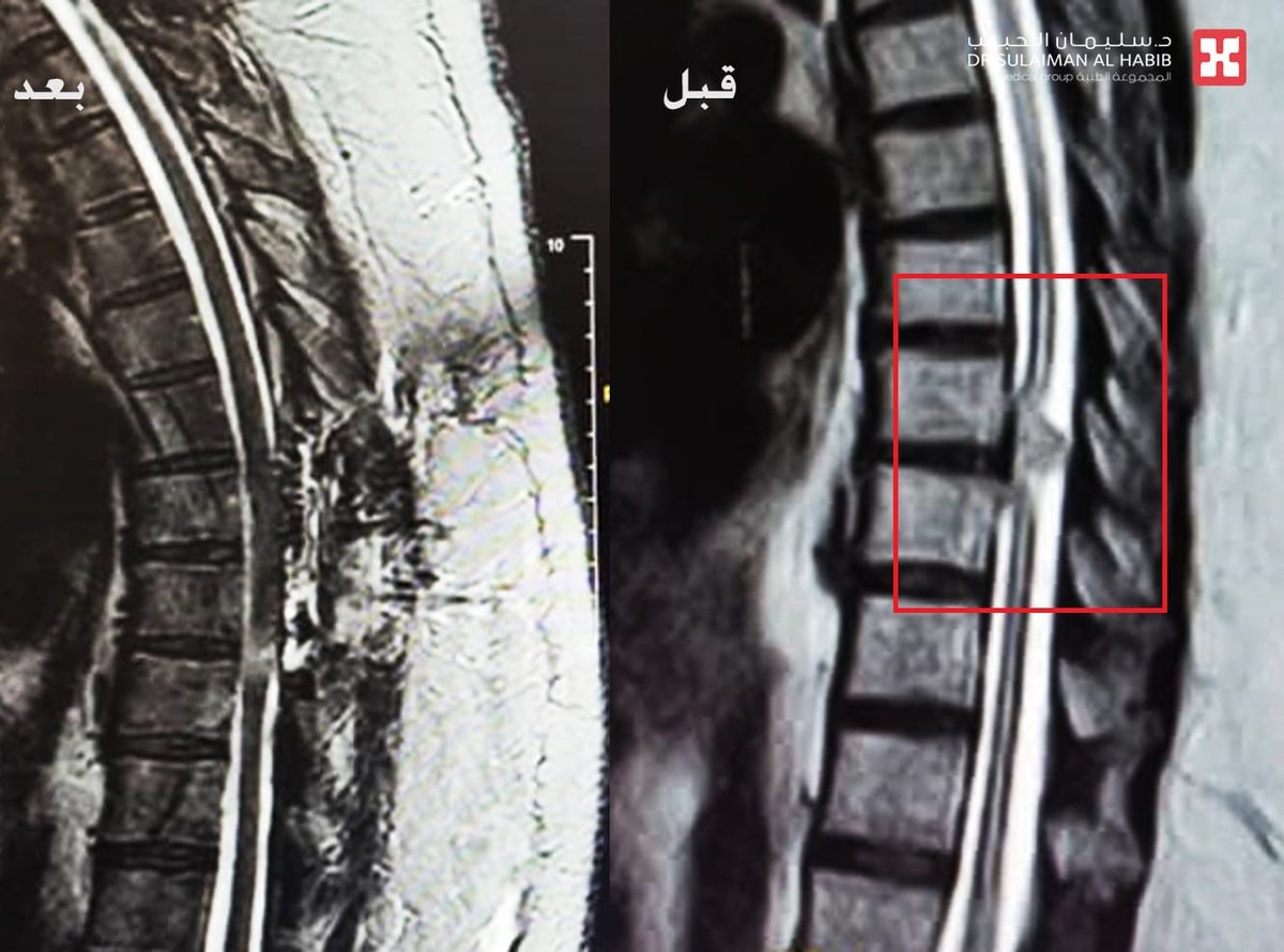 صورة الخبر