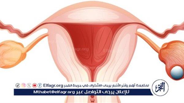 صورة الخبر